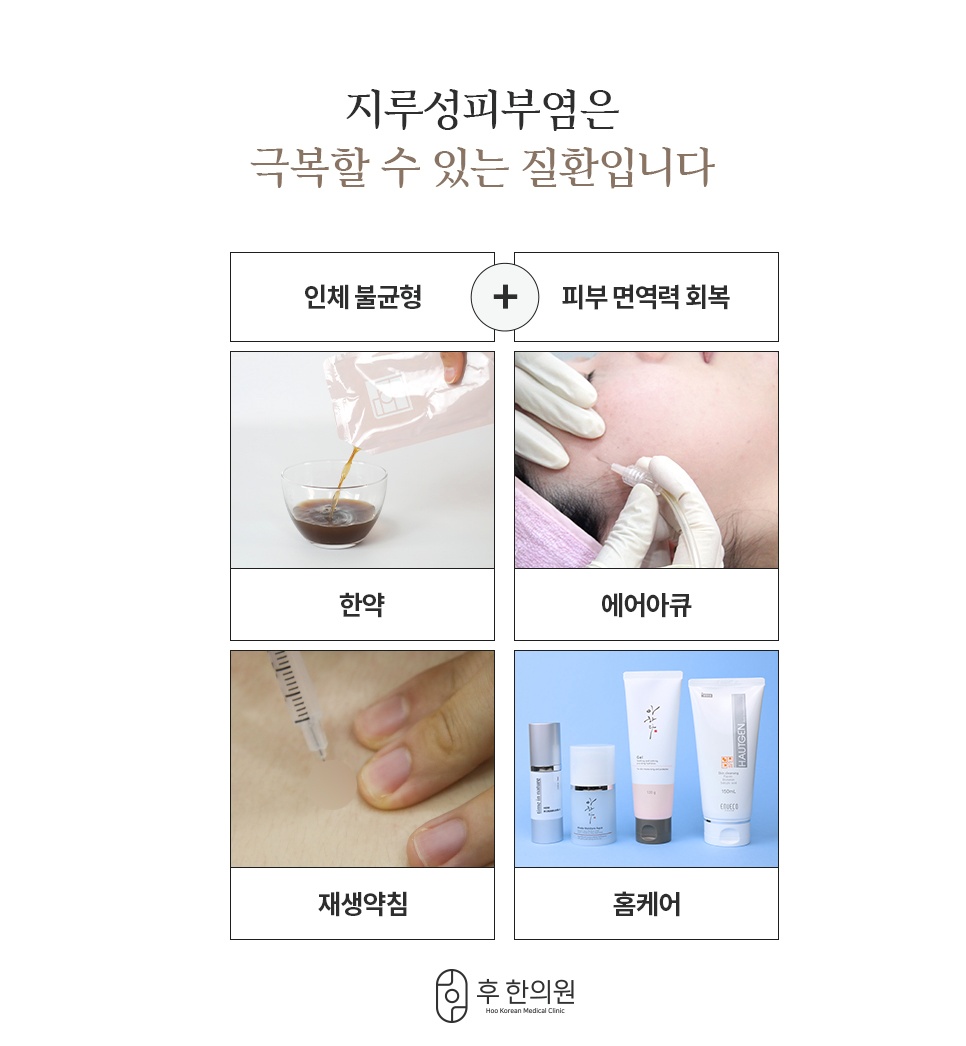 지루성피부염 한의원 치료 구성, 한약·에어아큐·재생약침·홈케어