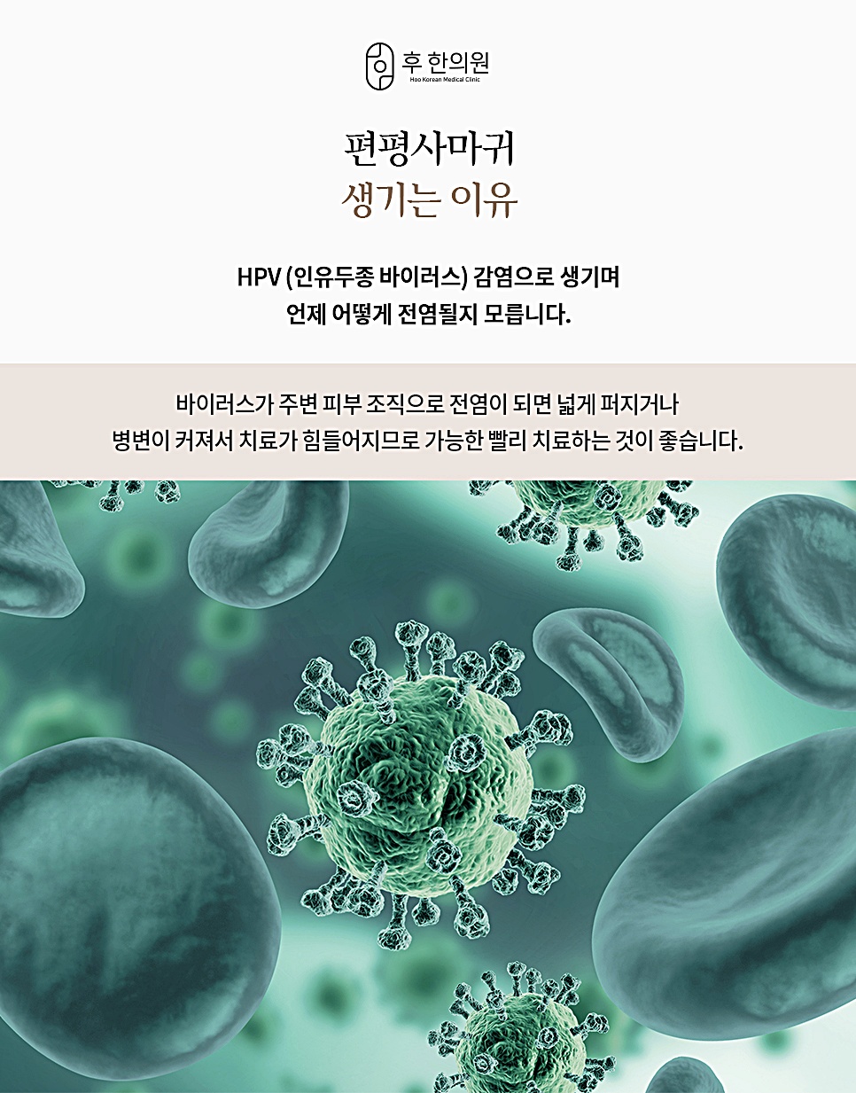 청주 편평사마귀 무제한 제거하는 이유를 보여주는 HPV 인유두종 바이러스 이미지