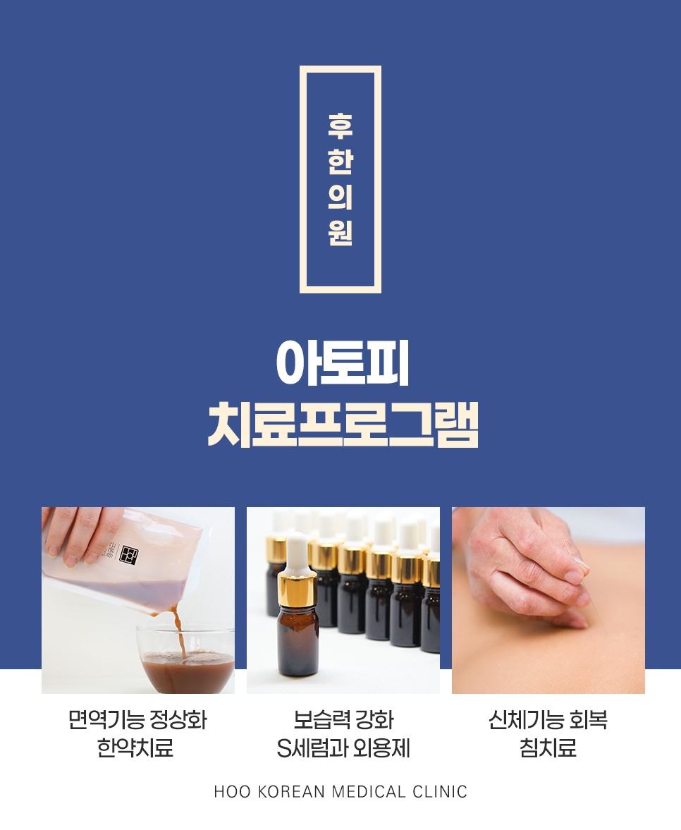 후한의원 아토피 치료프로그램 - 한약치료, S세럼 외용제, 침치료