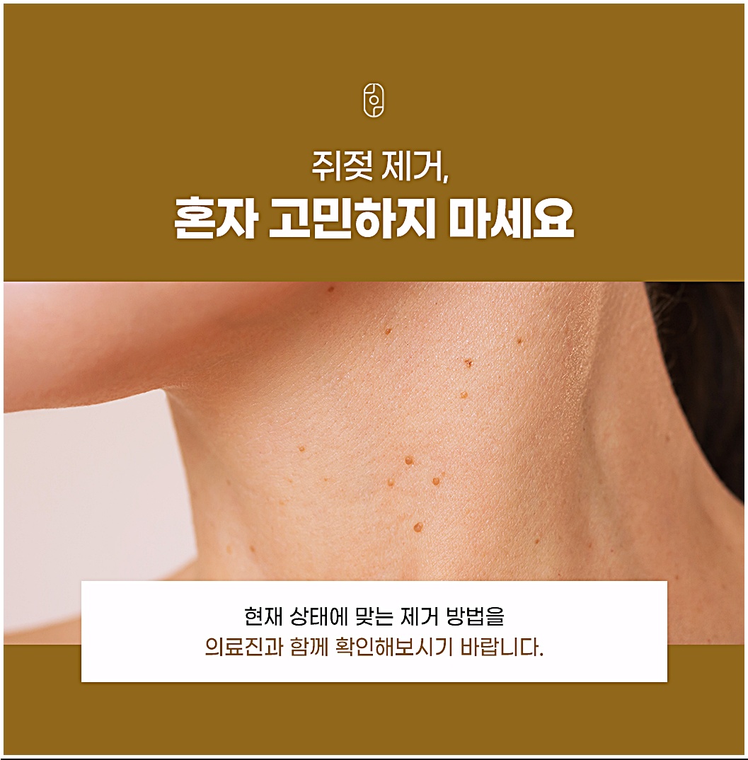 청주쥐젖제거 의료진과 함께 제거 방법을 확인하는 상담 과정
