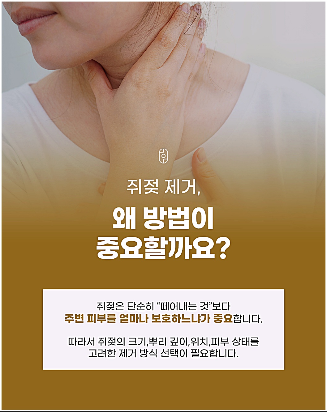 청주쥐젖 제거 시 방법 선택의 중요성을 보여주는 이미지
