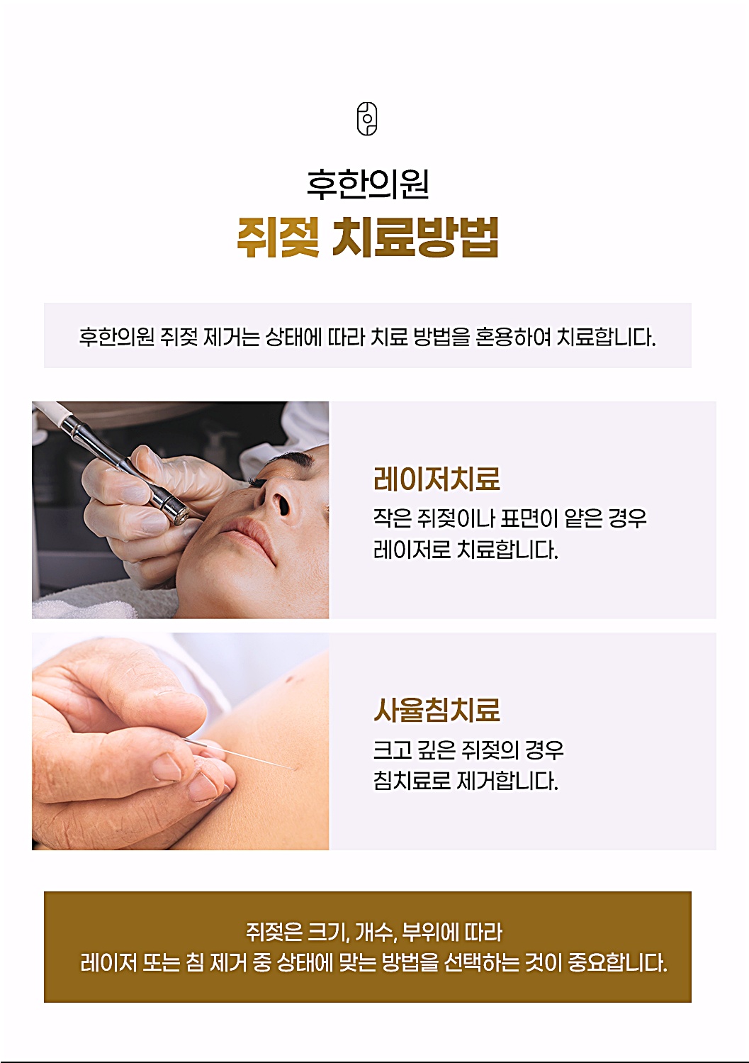 쥐젖 크기와 깊이에 따라 치료 방식을 안내하는 후한의원 치료방법 카드