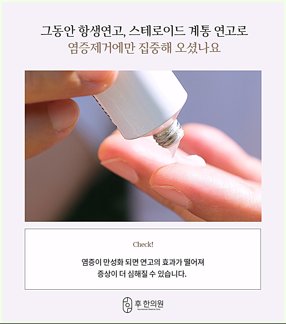 스테로이드 계통 연고 사용 이미지 - 염증 제거 연고의 한계