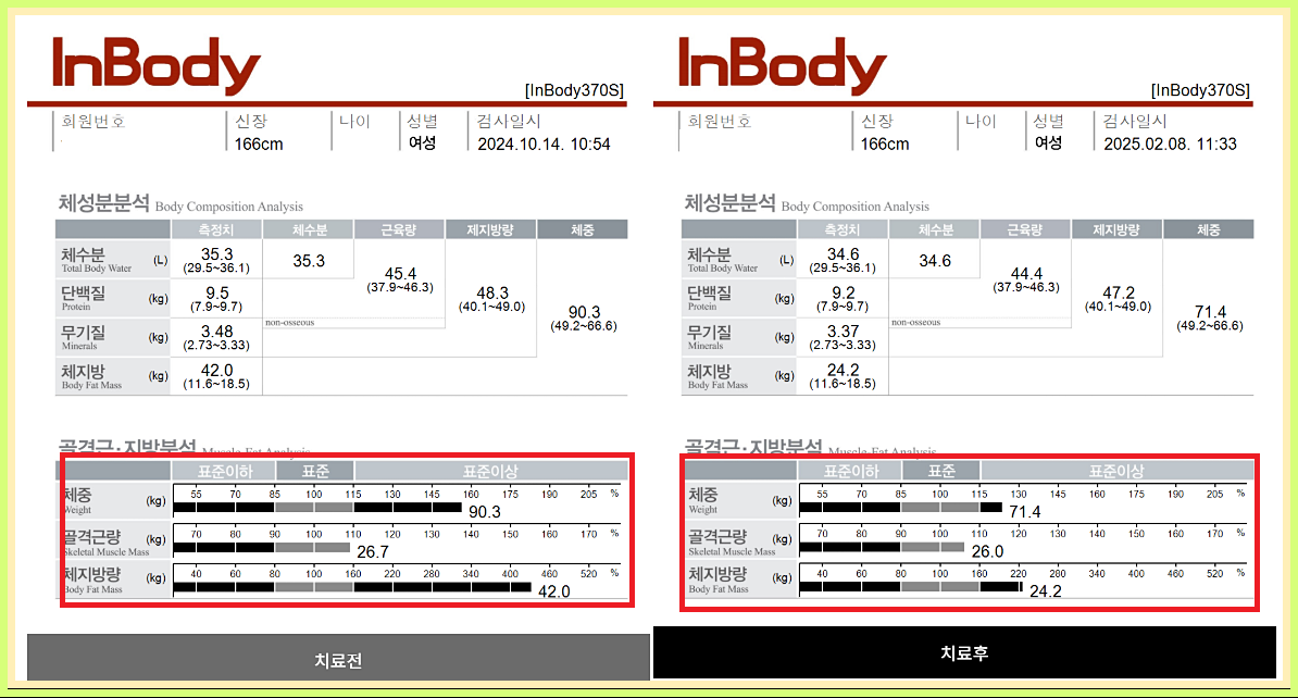 인바디 사례