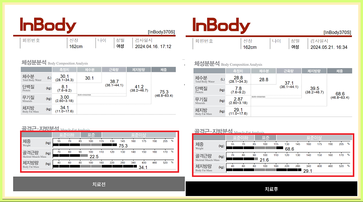 청주다이어트한약 복용 감량 인바디 사례