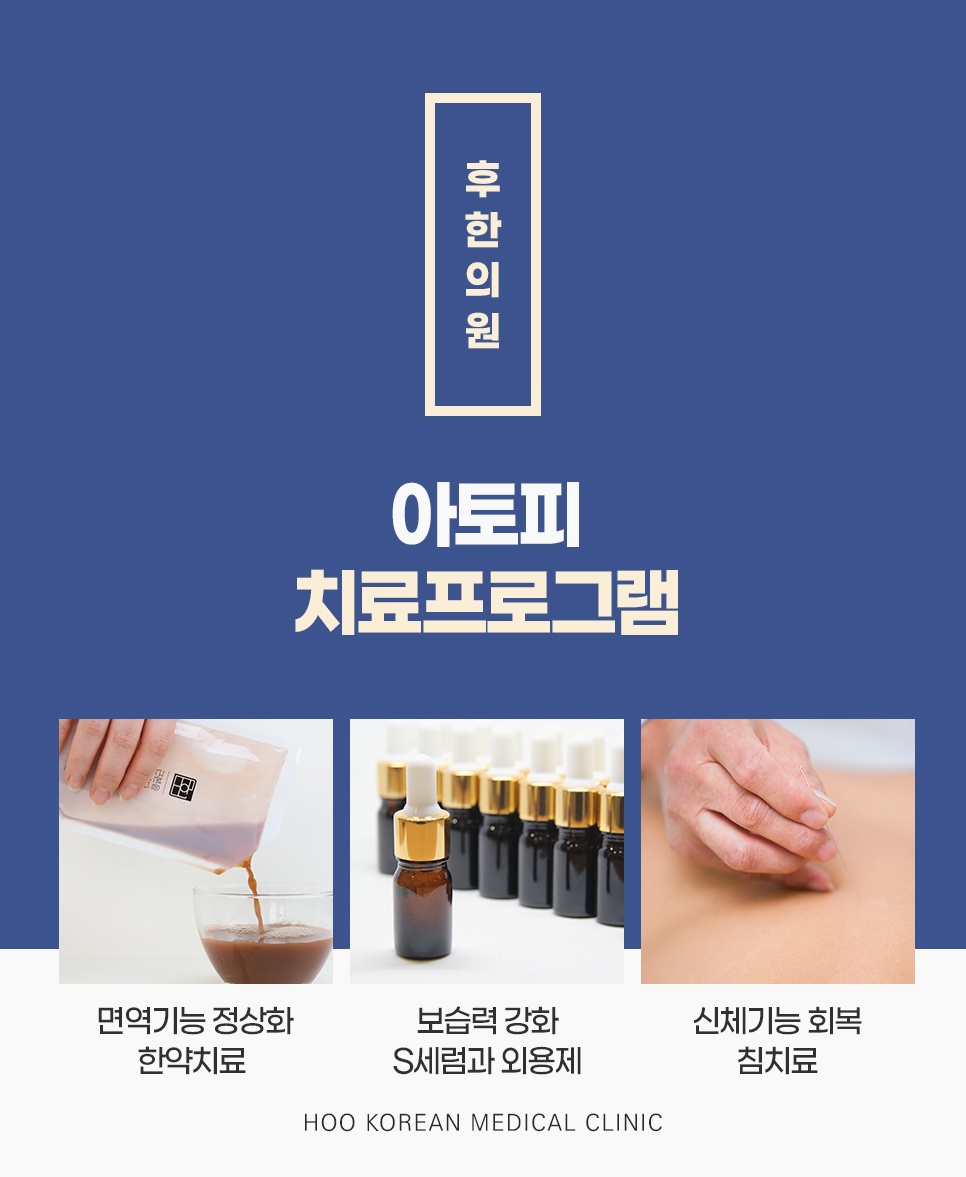 한약, S세럼과 외용제, 침치료로 구성한 후한의원 아토피 치료프로그램 3가지