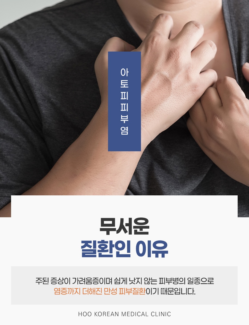 가슴을 긁는 손으로 보는 가려움증과 염증이 겹친 만성 피부질환 아토피피부염 안내