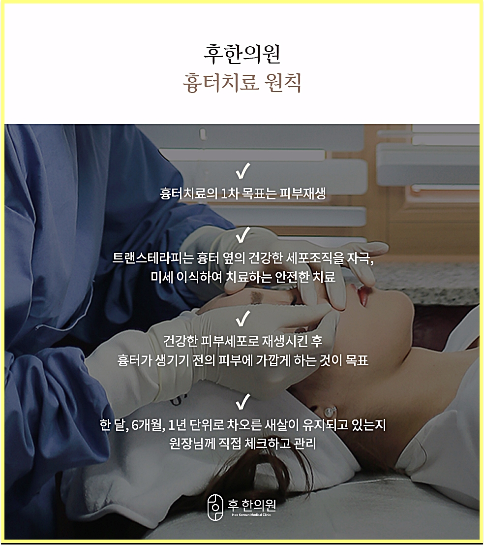 후한의원 흉터치료 원칙과 트랜스테라피 안내