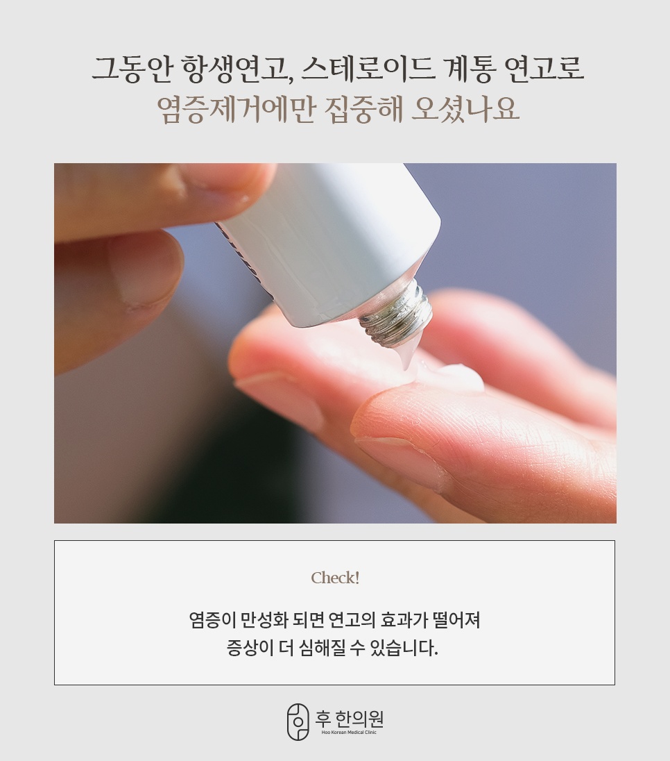 항생연고 스테로이드 연고 만성 염증