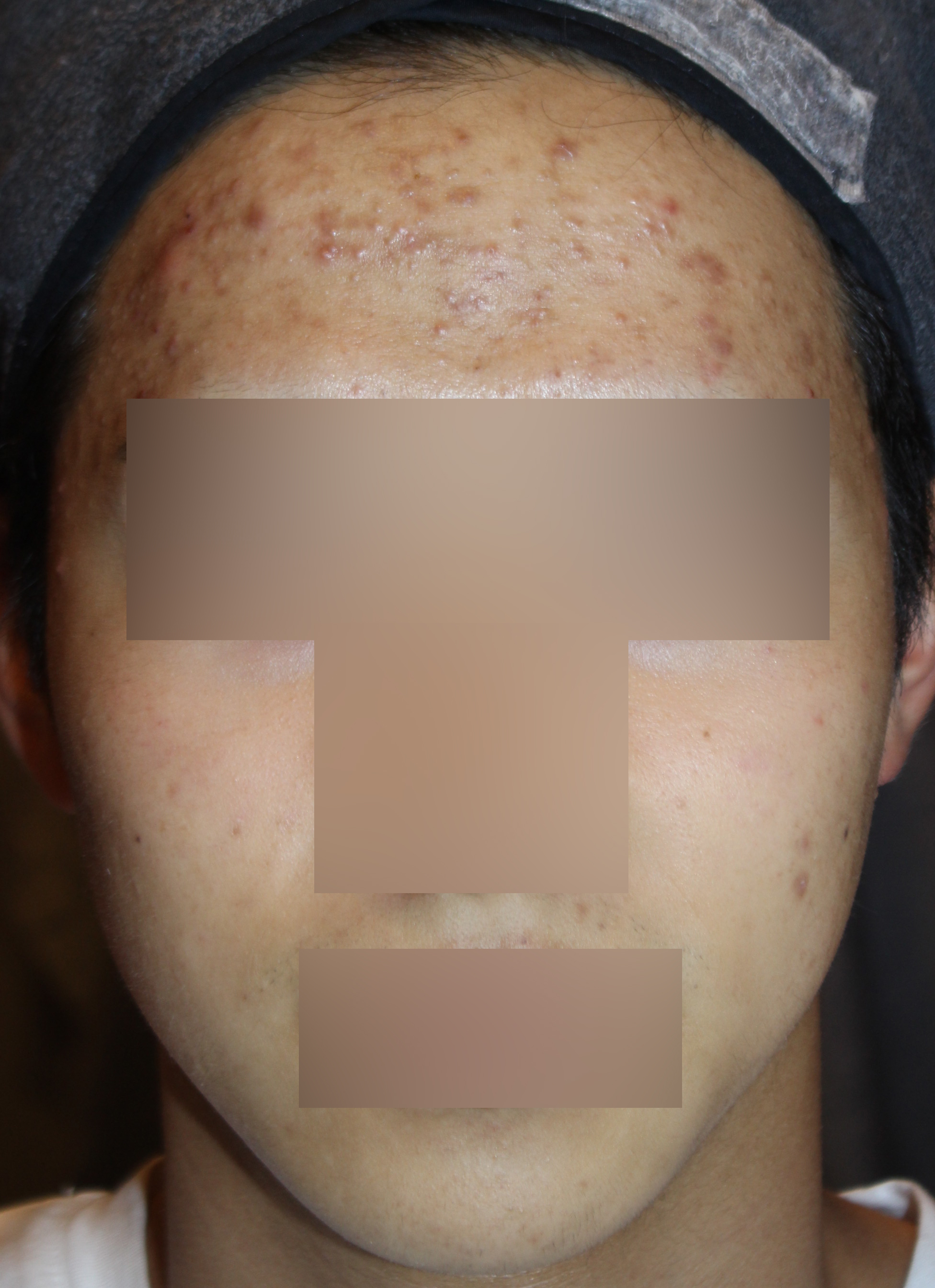 Before