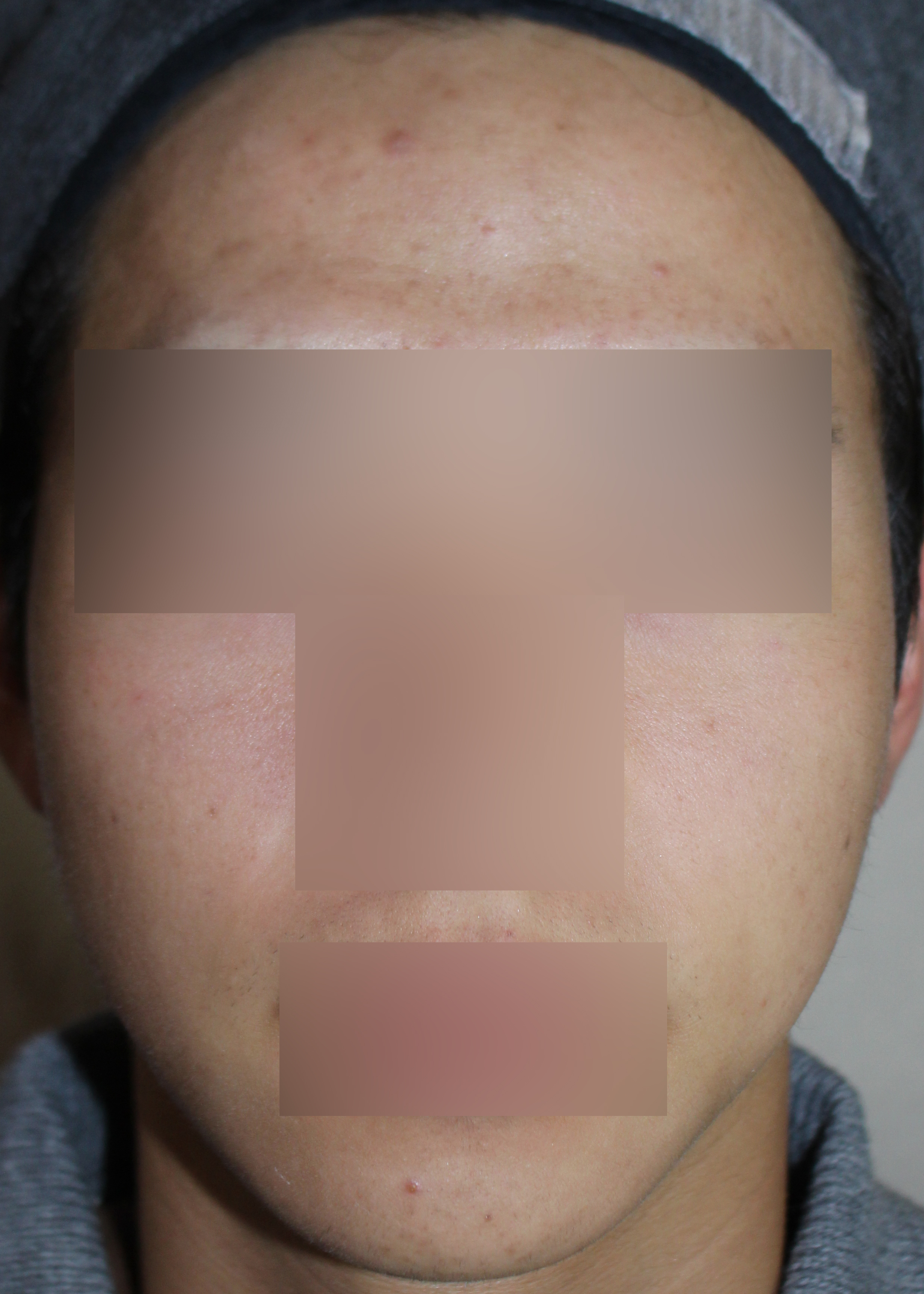 After