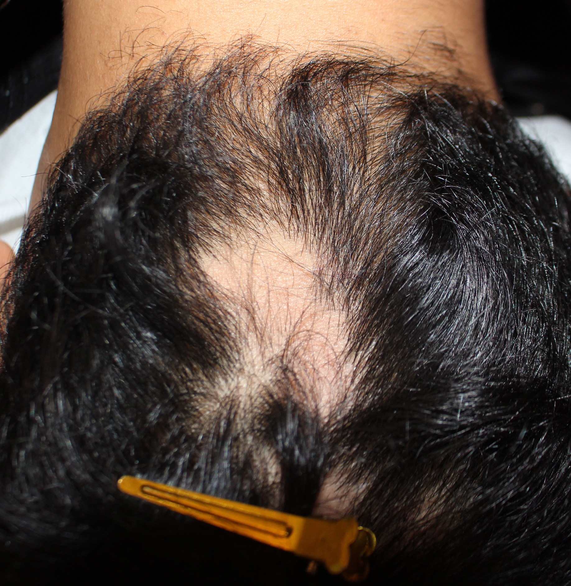 Before